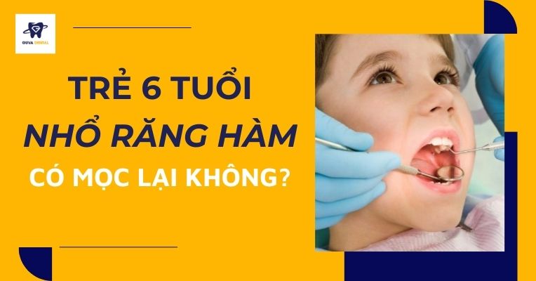 6 tuổi nhổ răng hàm có mọc lại không? Câu trả lời và những lưu ý quan trọng